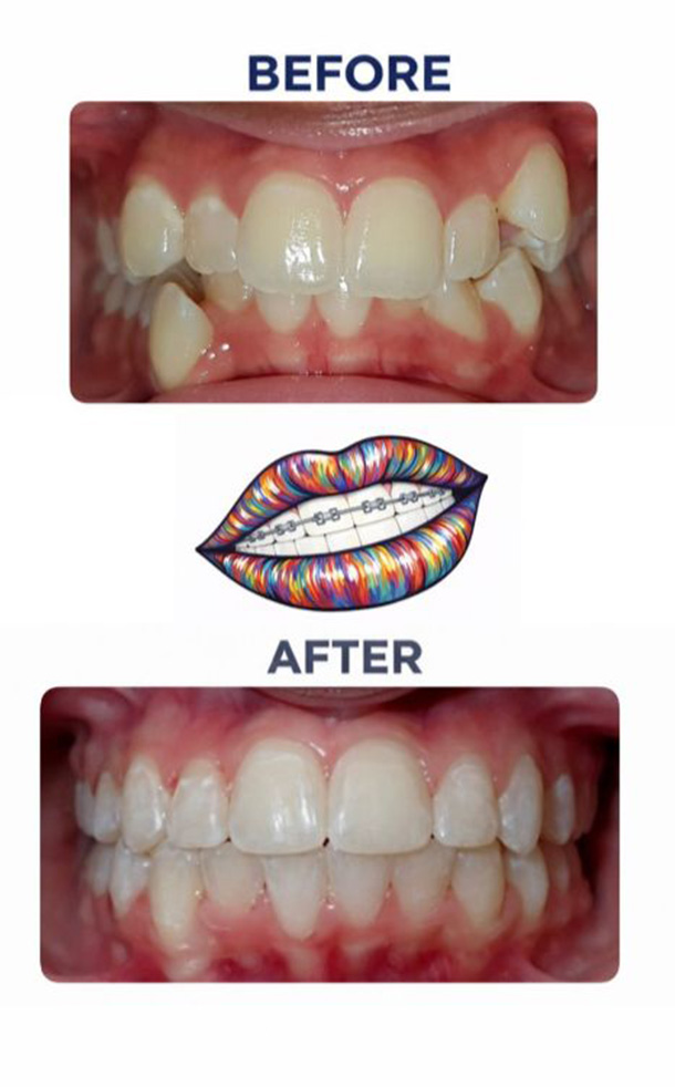 Before and After Photo
