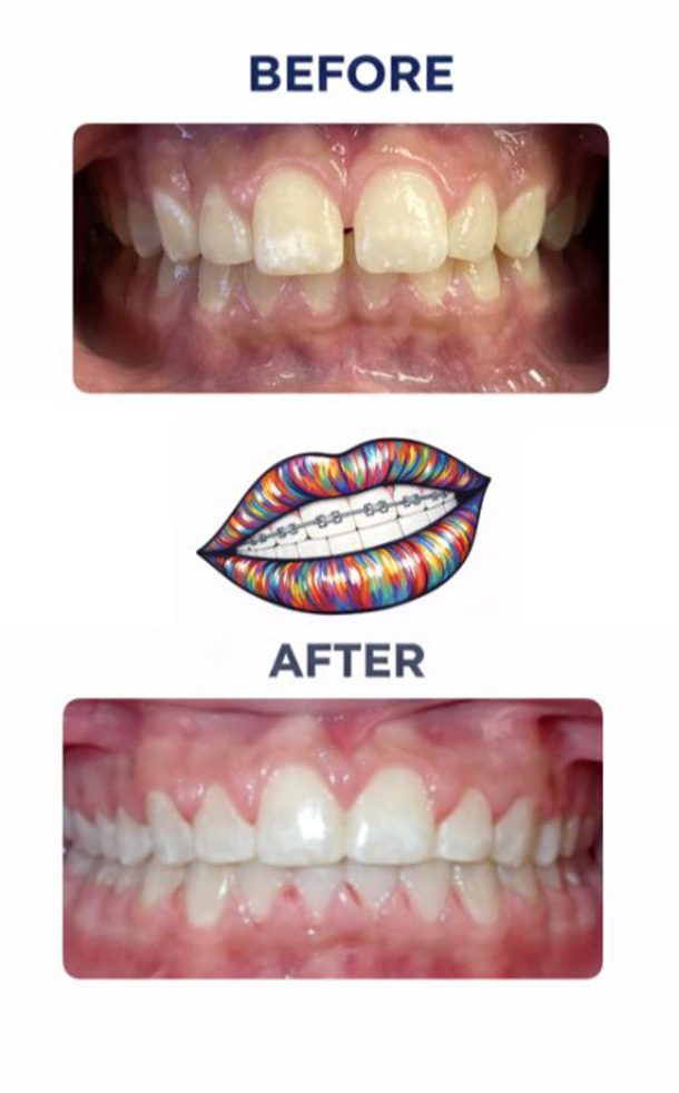 Before and After Photo