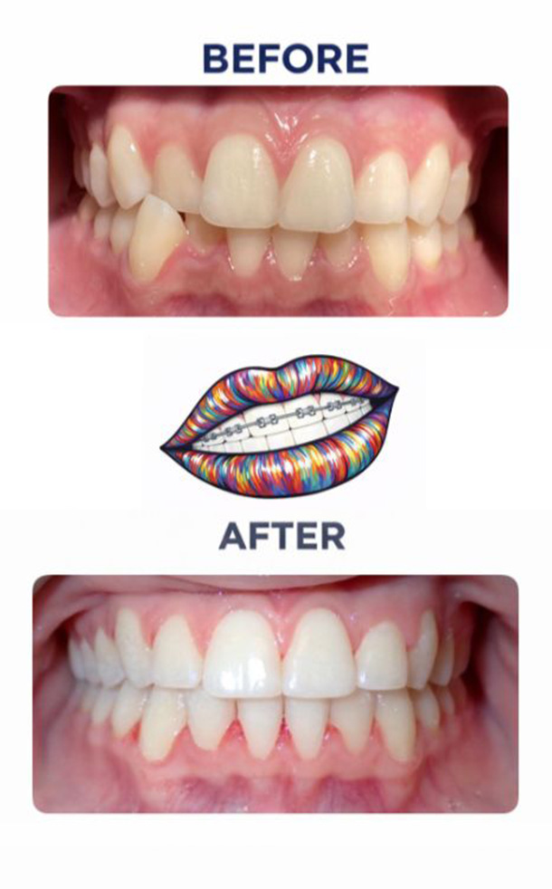 Before and After Photo