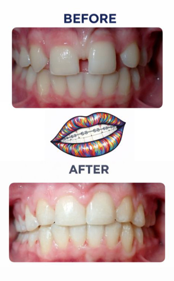 Before and After Photo