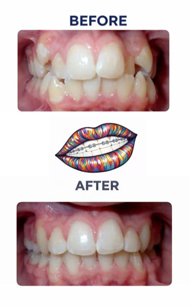 Before and After Photo