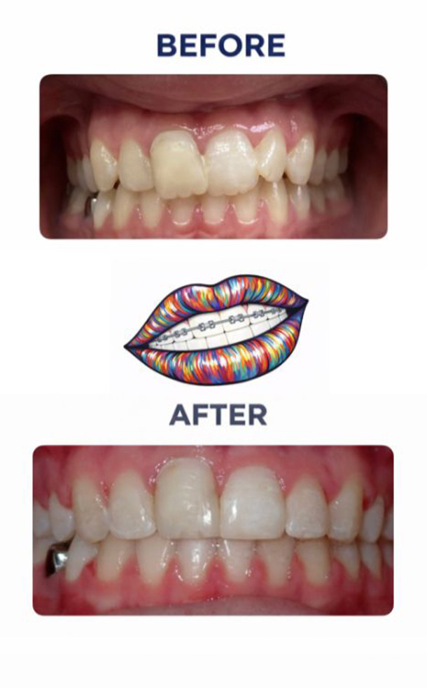 Before and After Photo