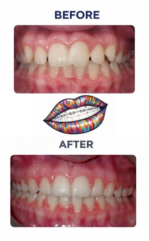 Before and After Photo