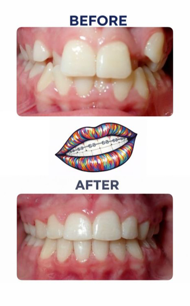 Before and After Photo