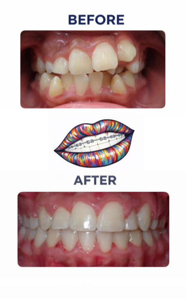 Before and After Photo