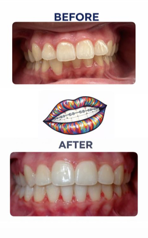 Before and After Photo
