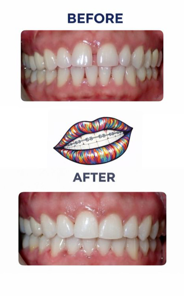 Before and After Photo
