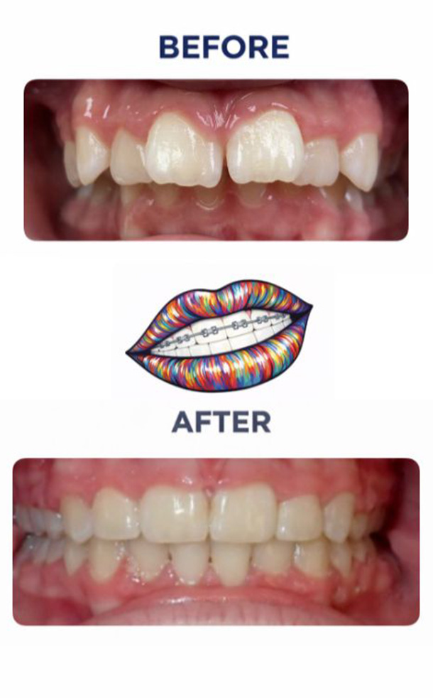 Before and After Photo