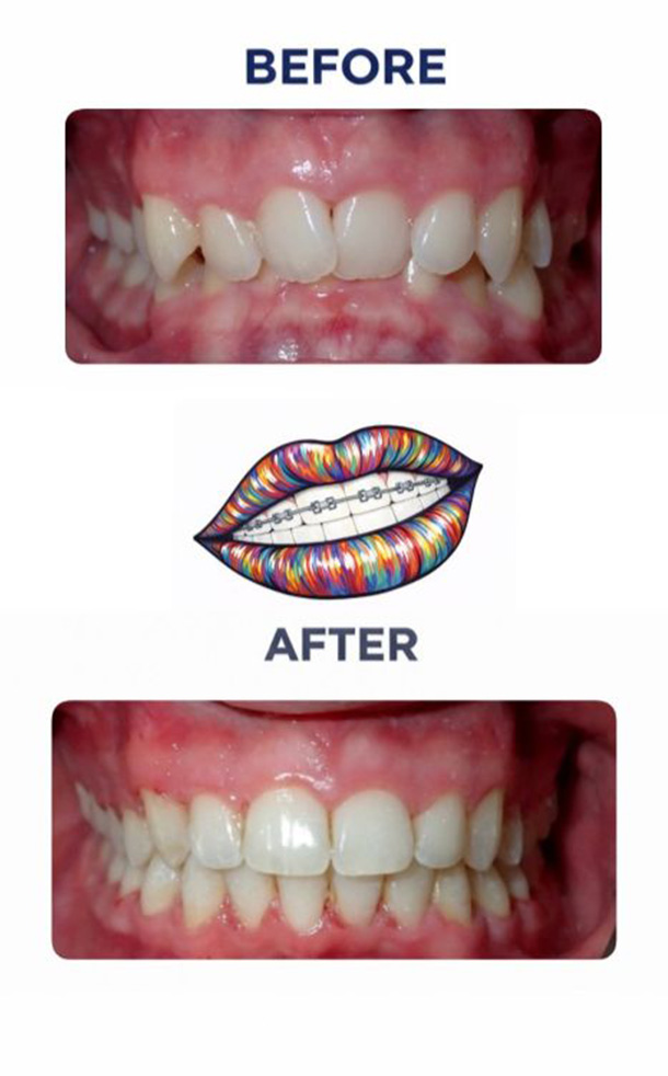 Before and After Photo