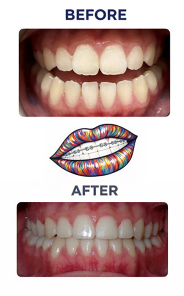 Before and After Photo