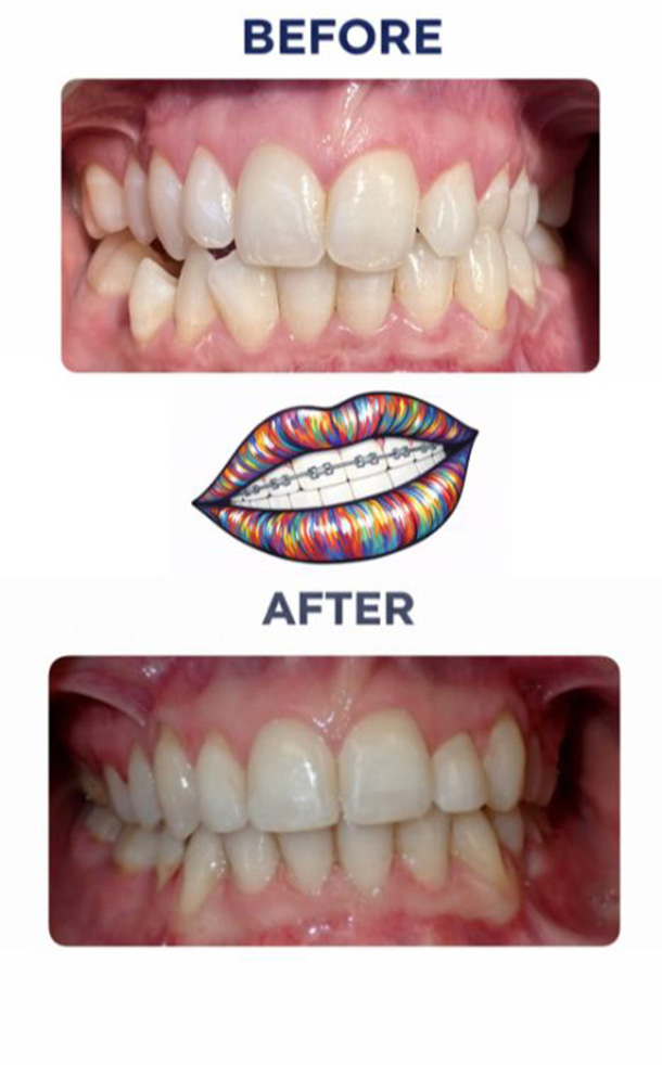 Before and After Photo