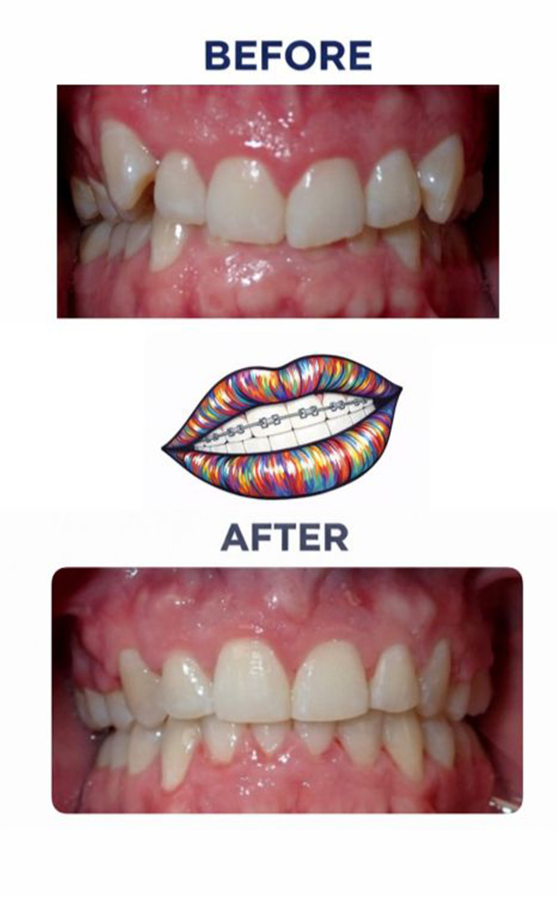 Before and After Photo