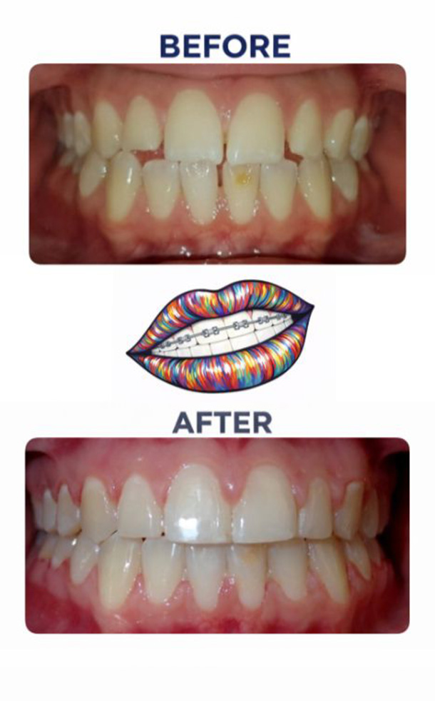 Before and After Photo