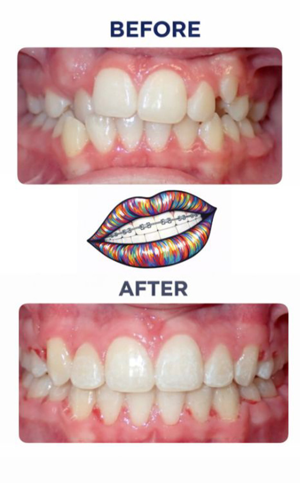 Before and After Photo