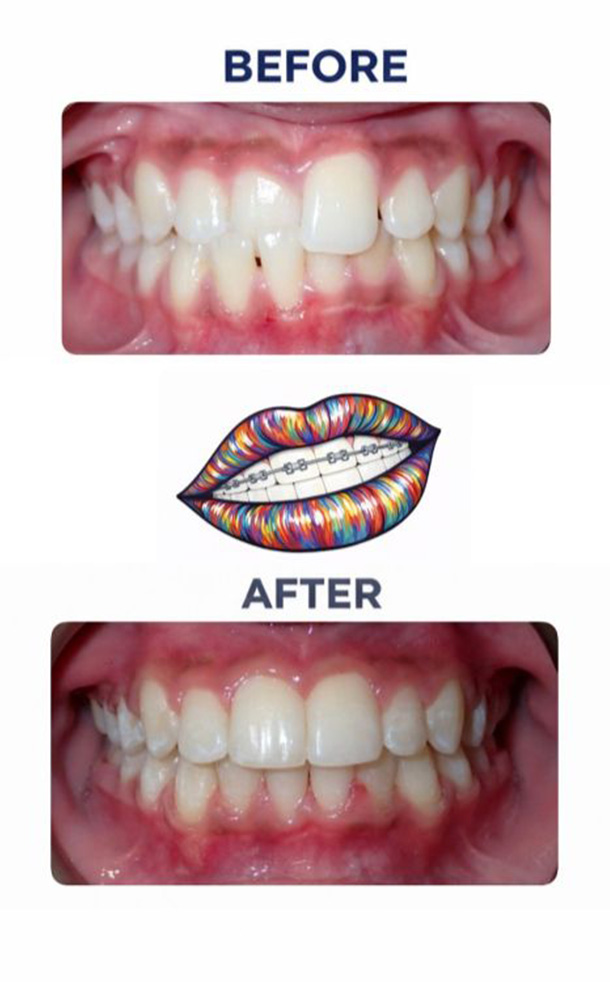 Before and After Photo