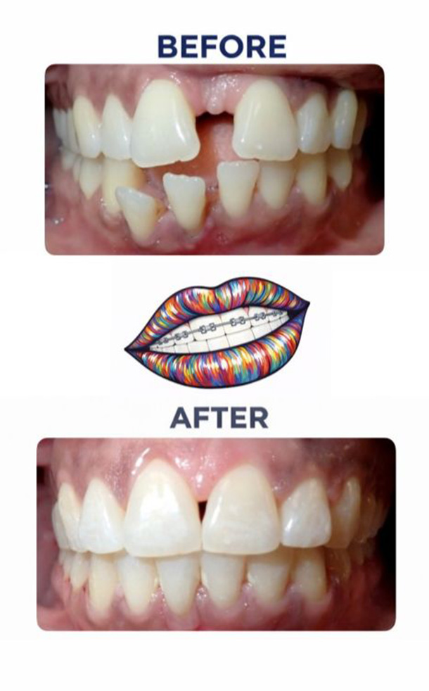 Before and After Photo