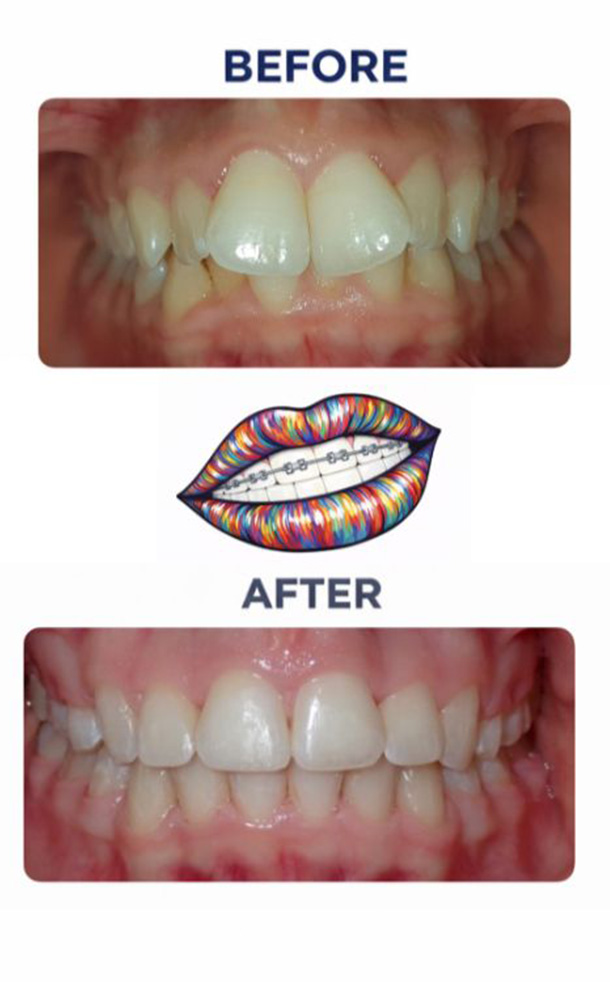 Before and After Photo