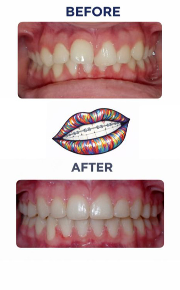 Before and After Photo