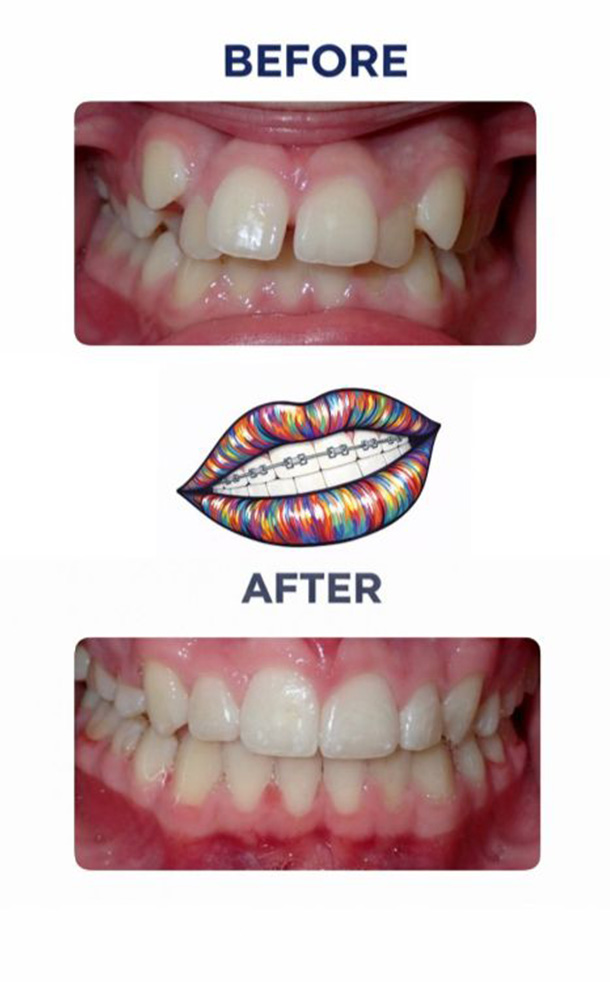 Before and After Photo