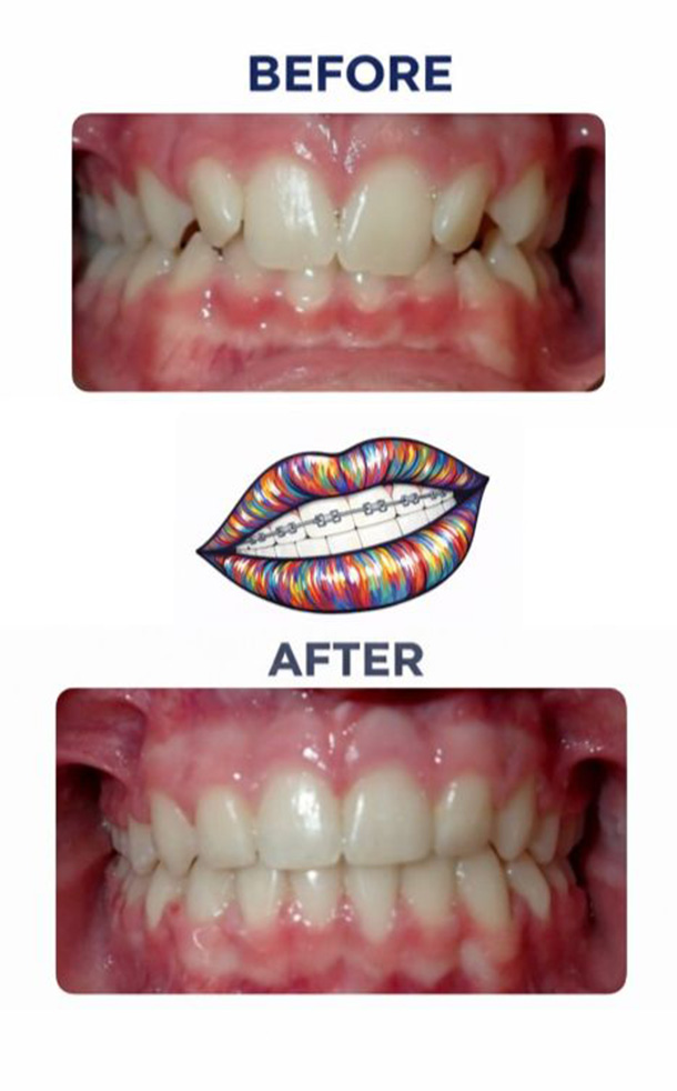 Before and After Photo