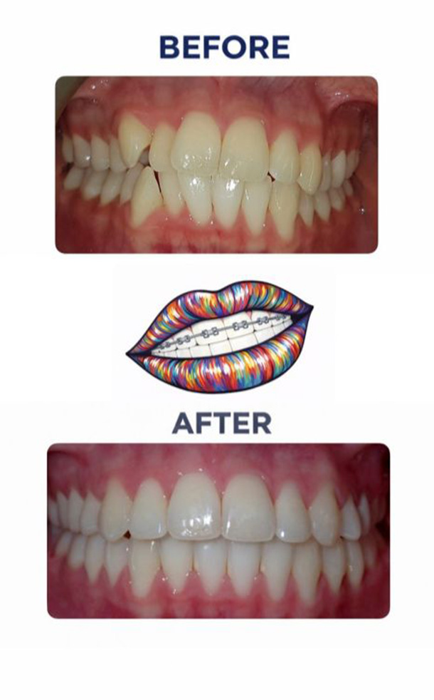 Before and After Photo