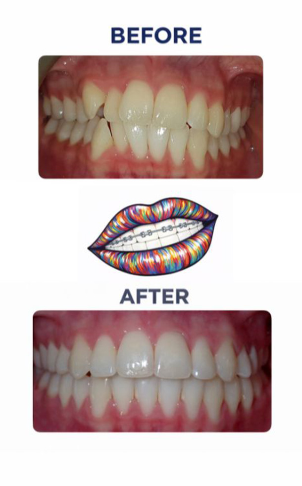 Before and After Photo