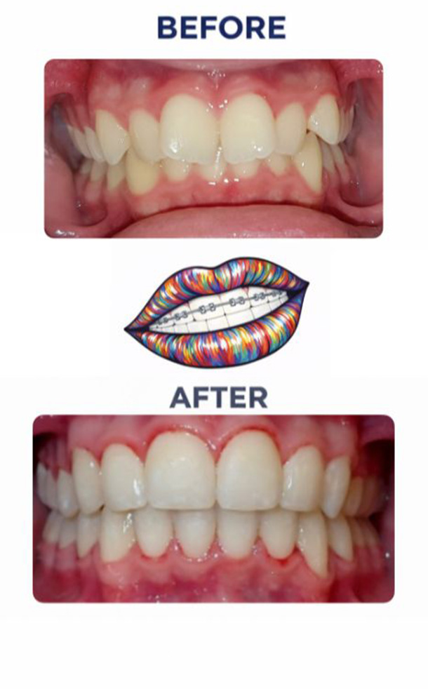 Before and After Photo