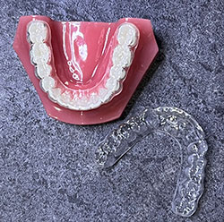 retainers
