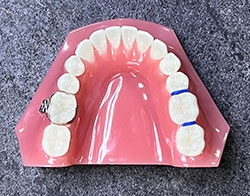 separator